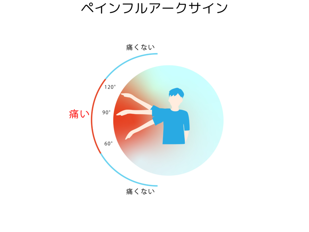 ペイン フル アーク サイン